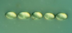 Zarodniki mączniaka prawdziwego pod mikroskopem.